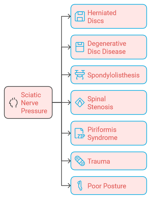 Causes of Sciatica